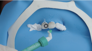 Estetica dentale