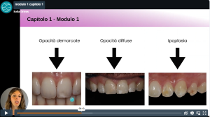 Estetica dentale